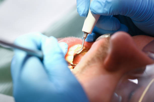 Best Emergency Broken Tooth Repair in Lwa, CA