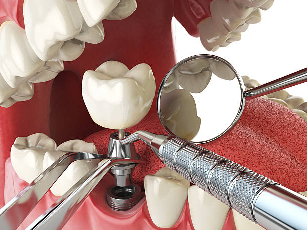 Best Emergency Orthodontic Repairs in Lwa, CA